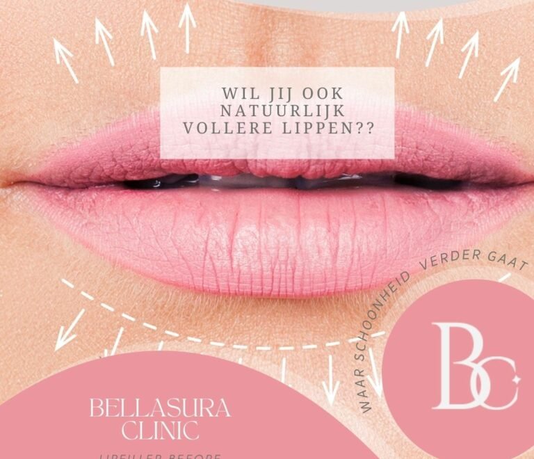 Fillers